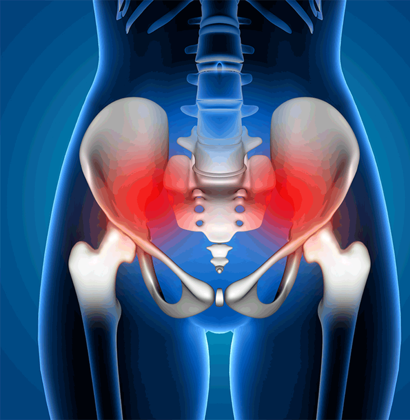 Sacroiliac Joint Dysfunction - PHILLIP ISLAND MASSAGE THERAPY